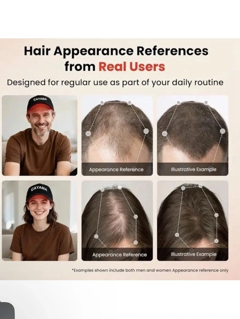 Red Light Therapy Hair Growth Cap Men & Women Infrared 528 LED Fuller Thicker